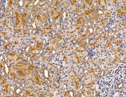 Invitrogen MYO3B Polyclonal Antibody 100 &mu;L; Unconjugated:Antibodies,