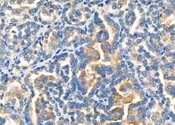 Invitrogen MYO5C Polyclonal Antibody 100 &mu;L; Unconjugated:Antibodies,