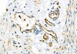 Invitrogen MYO5C Polyclonal Antibody 100 &mu;L; Unconjugated:Antibodies,