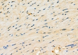 Invitrogen MYO5C Polyclonal Antibody 100 &mu;L; Unconjugated:Antibodies,