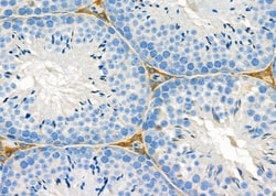 Invitrogen MYO5C Polyclonal Antibody 100 &mu;L; Unconjugated:Antibodies,