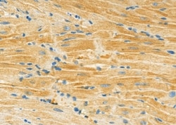 Invitrogen&trade;&nbsp;MYO6 Polyclonal Antibody