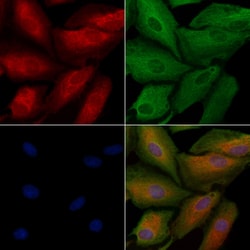Invitrogen MYO16 Polyclonal Antibody 100 &mu;L; Unconjugated:Antibodies,