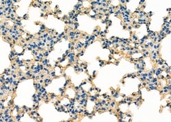 Invitrogen MYO16 Polyclonal Antibody 100 &mu;L; Unconjugated:Antibodies,