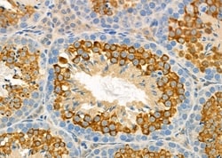 Invitrogen MYO16 Polyclonal Antibody 100 &mu;L; Unconjugated:Antibodies,