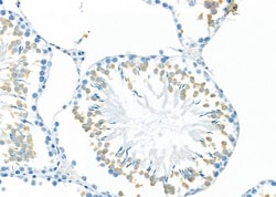 Invitrogen MYO16 Polyclonal Antibody 100 &mu;L; Unconjugated:Antibodies,
