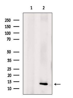 NDUFA5 Polyclonal Antibody:Antibodies, Polyclonal