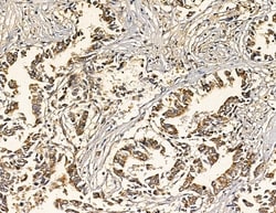 Invitrogen NDUFB3 Polyclonal Antibody 100 &mu;L; Unconjugated:Antibodies,