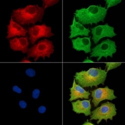 Invitrogen NDUFB5 Polyclonal Antibody 100 μL; Unconjugated:Antibodies,