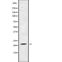 Invitrogen NDUFB5 Polyclonal Antibody 100 μL; Unconjugated:Antibodies,