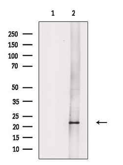 Invitrogen NDUFB8 Polyclonal Antibody 100 &mu;L; Unconjugated:Antibodies,