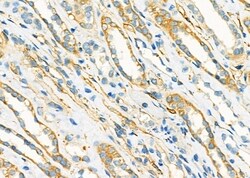 Invitrogen NDUFC1 Polyclonal Antibody 100 &mu;L; Unconjugated:Antibodies,