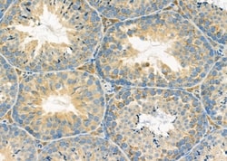 Invitrogen NDUFC1 Polyclonal Antibody 100 &mu;L; Unconjugated:Antibodies,