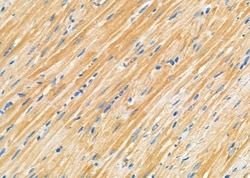 Invitrogen NDUFC1 Polyclonal Antibody 100 &mu;L; Unconjugated:Antibodies,