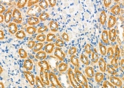 Invitrogen NDUFC1 Polyclonal Antibody 100 &mu;L; Unconjugated:Antibodies,