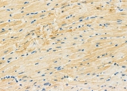 Invitrogen MT-ND4L Polyclonal Antibody 100 &mu;L; Unconjugated:Antibodies,