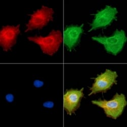 Invitrogen MT-ND6 Polyclonal Antibody 100 &mu;L; Unconjugated:Antibodies,