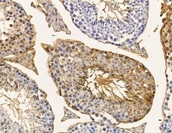 Invitrogen MT-ND6 Polyclonal Antibody 100 &mu;L; Unconjugated:Antibodies,