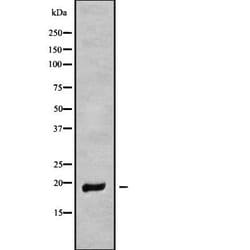 Invitrogen MT-ND6 Polyclonal Antibody 100 &mu;L; Unconjugated:Antibodies,