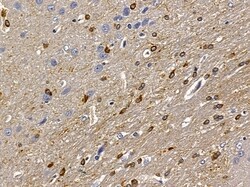 NKp44 Polyclonal Antibody:Antibodies, Polyclonal