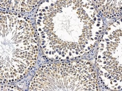 NKp44 Polyclonal Antibody:Antibodies, Polyclonal