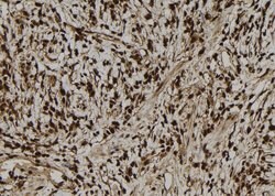 Invitrogen NGRN Polyclonal Antibody 100 &mu;L; Unconjugated:Antibodies,