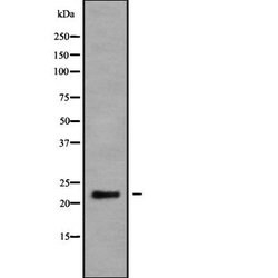 Invitrogen Neurensin 2 Polyclonal Antibody 100 &mu;L; Unconjugated:Antibodies,
