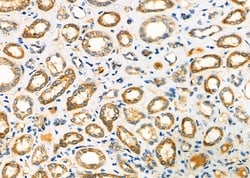 Invitrogen NXPH2 Polyclonal Antibody 100 &mu;L; Unconjugated:Antibodies,