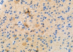 Invitrogen NCALD Polyclonal Antibody 100 &mu;L | Buy Online | Invitrogen&trade; | Fisher Scientific
