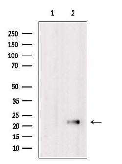 Invitrogen NCALD Polyclonal Antibody 100 &mu;L | Buy Online | Invitrogen&trade; | Fisher Scientific