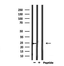 Invitrogen SCG5 Polyclonal Antibody 100 &mu;L; Unconjugated:Antibodies,