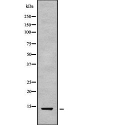 Invitrogen NMB Polyclonal Antibody 100 &mu;L; Unconjugated:Antibodies,