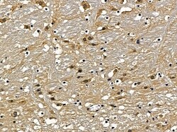 Invitrogen NAV2 Polyclonal Antibody 100 &mu;L; Unconjugated:Antibodies,