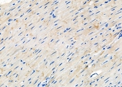 Invitrogen CHRNB3 Polyclonal Antibody 100 &mu;L; Unconjugated:Antibodies,
