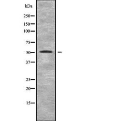 Invitrogen CHRNB3 Polyclonal Antibody 100 &mu;L; Unconjugated:Antibodies,