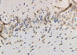 Invitrogen NTS Polyclonal Antibody 100 &mu;L; Unconjugated:Antibodies,