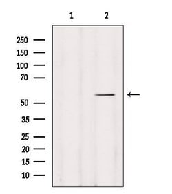 Invitrogen DFNA5 Polyclonal Antibody 100 &mu;L | Buy Online | Invitrogen&trade; | Fisher Scientific