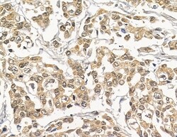Invitrogen NUP205 Polyclonal Antibody 100 &mu;L; Unconjugated:Antibodies,