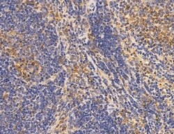 Invitrogen NUP205 Polyclonal Antibody 100 &mu;L; Unconjugated:Antibodies,