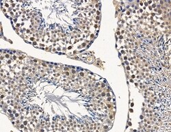 Invitrogen NUP205 Polyclonal Antibody 100 &mu;L; Unconjugated:Antibodies,