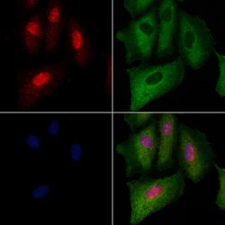 Invitrogen NUP88 Polyclonal Antibody 100 &mu;L; Unconjugated:Antibodies,