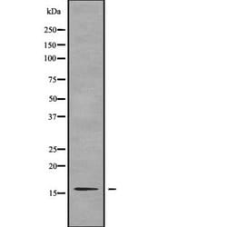 Invitrogen TNP2 Polyclonal Antibody 100 &mu;L; Unconjugated:Antibodies,