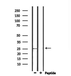 Invitrogen Nop25 Polyclonal Antibody 100 &mu;L; Unconjugated:Antibodies,