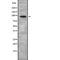 Invitrogen NOP14 Polyclonal Antibody 100 &mu;L; Unconjugated:Antibodies,
