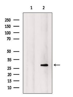 Invitrogen NOL7 Polyclonal Antibody 100 &mu;L | Buy Online | Invitrogen&trade; | Fisher Scientific