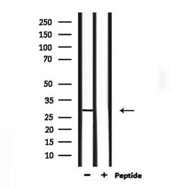 Invitrogen NOL7 Polyclonal Antibody 100 &mu;L | Buy Online | Invitrogen&trade; | Fisher Scientific