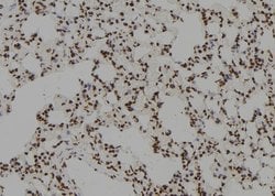 Invitrogen ZCCHC17 Polyclonal Antibody 100 &mu;L; Unconjugated:Antibodies,