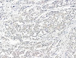 Invitrogen ZCCHC17 Polyclonal Antibody 100 &mu;L; Unconjugated:Antibodies,