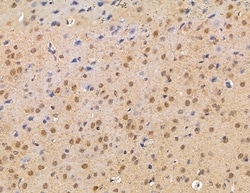 Invitrogen ZCCHC17 Polyclonal Antibody 100 &mu;L; Unconjugated:Antibodies,