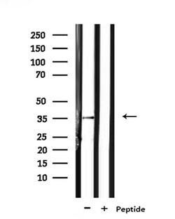 Invitrogen OR6N1 Polyclonal Antibody 100 &mu;L | Buy Online | Invitrogen&trade; | Fisher Scientific